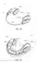 Fig. 14 - Method and apparatus for treating sleep apnea