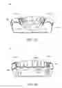 Fig. 15 - Method and apparatus for treating sleep apnea