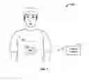 Fig. 02 - Implantable medical device with control of neural stimulation based on battery status