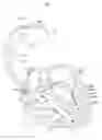 Fig. 01 - Method and apparatus for phrenic stimulation detection