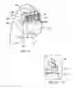 Fig. 14 - Apparatus and systems for finger exercise