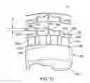 Fig. 15 - Apparatus and systems for finger exercise