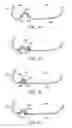 Fig. 17 - Golf club head with flexure