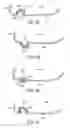 Fig. 18 - Golf club head with flexure