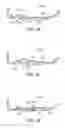 Fig. 23 - Golf club head with flexure
