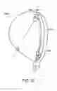 Fig. 27 - Golf club head with flexure