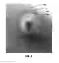 Fig. 03 - Fluid delivery devices, systems, and methods