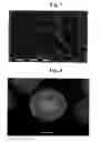 Fig. 05 - Method for producing a metal particle
