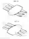 Fig. 08 - Surface treatment device