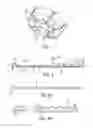 Fig. 02 - APPARATUS AND METHOD FOR INCREASING THE TRACTION OF VEHICLE WHEELS