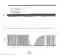 Fig. 03 - Asymmetrical reversible neuromuscular blocking agents of ultra-short, short, or intermediate duration