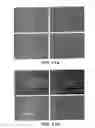 Fig. 12 - Selective delivery of molecules into cells or marking of cells in diseased tissue regions using environmentally sensitive transmembrane peptide