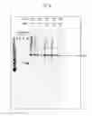 Fig. 07 - Compositions and methods for the treatment or prevention of hepatitis B virus infection