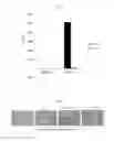 Fig. 04 - COMPOSITION INCLUDING GELSOLIN AS EFFECTIVE INGREDIENT FOR INDUCING DIFFERENTIATION INTO DENDRITIC CELL AND METHOD OF INDUCING DIFFERENTIATION INTO DENDRITIC CELL