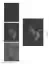 Fig. 03 - Deriving brown adipose tissue cells