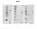 Fig. 06 - Generation of native recombinant secreted human endoplasmic reticulum chaperones by using their native signal sequences in yeast expression systems