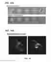 Fig. 16 - COMPOSITIONS FOR IN SITU LABELING OF BACTERIAL CELL WALLS WITH FLUOROPHORES AND METHODS OF USE THEREOF