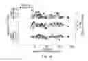 Fig. 03 - Urine mRNA profile and acute dysfunction of kidney allograft