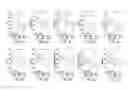 Fig. 04 - Urine mRNA profile and acute dysfunction of kidney allograft