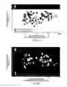 Fig. 10 - Urine mRNA profile and acute dysfunction of kidney allograft