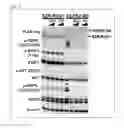Fig. 10 - FGFR2 FUSION GENE