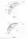 Fig. 06 - Guide vane for a turbomachine having a sealing device; stator, as well as turbomachine