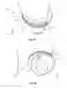 Fig. 08 - Guide vane for a turbomachine having a sealing device; stator, as well as turbomachine
