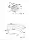 Fig. 10 - Quick-threaded rod locking device and method