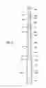 Fig. 11 - Apparatus and methods for supporting an elongated member