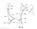 Fig. 18 - Apparatus and methods for supporting an elongated member