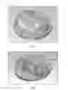 Fig. 09 - LED light-diffusing lens adopting asymmetric free-form surface expression
