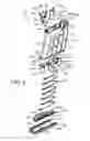 Fig. 03 - Rifle stock