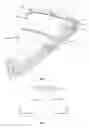 Fig. 02 - Foldable shield