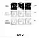 Fig. 07 - Motion tracking with reduced on-body sensors set
