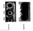 Fig. 18 - METHOD AND SYSTEM FOR DETERMINING THE QUALITY OF PHARMACEUTICAL PRODUCTS
