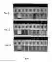 Fig. 06 - Methods and Devices for Analytical Sensing of Biogenic Amines