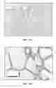 Fig. 02 - Detection method of mammary gland disease