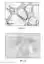 Fig. 03 - Detection method of mammary gland disease