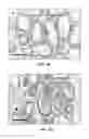 Fig. 04 - Detection method of mammary gland disease