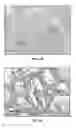 Fig. 07 - Detection method of mammary gland disease