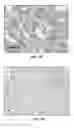 Fig. 08 - Detection method of mammary gland disease