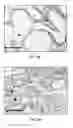 Fig. 10 - Detection method of mammary gland disease