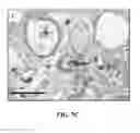 Fig. 12 - Detection method of mammary gland disease