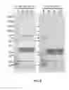 Fig. 13 - Detection method of mammary gland disease
