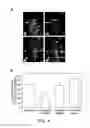 Fig. 05 - Method of detecting cancer using delta-catenin