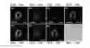 Fig. 14 - METHOD USING FLUORESCENT TURN-ON PROBES FOR CELL-SPECIFIC DETECTION