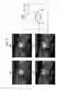 Fig. 07 - Systems and methods for myocardial perfusion MRI without the need for ECG gating and additional systems and methods for improved cardiac imaging