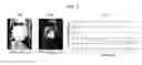 Fig. 08 - Systems and methods for myocardial perfusion MRI without the need for ECG gating and additional systems and methods for improved cardiac imaging