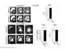 Fig. 09 - Systems and methods for myocardial perfusion MRI without the need for ECG gating and additional systems and methods for improved cardiac imaging