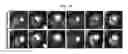 Fig. 19 - Systems and methods for myocardial perfusion MRI without the need for ECG gating and additional systems and methods for improved cardiac imaging